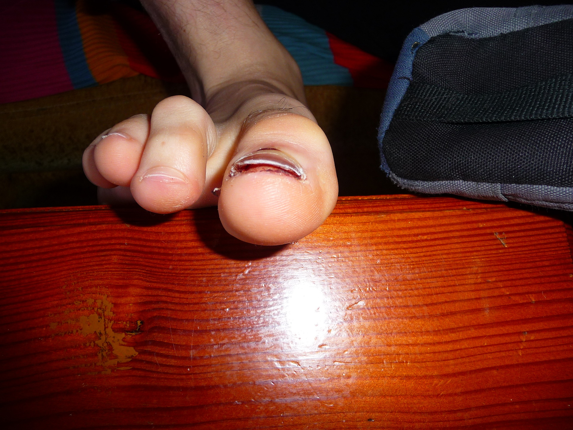 15 dnů na hřebeni Tater...