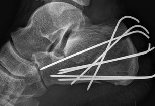 Mára Holeček: Ježek v kleci