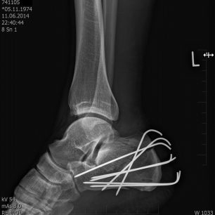 Ježek v kleci...., a dva měsíce v řiti.