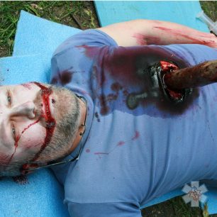 Pronikající poranění hrudníku