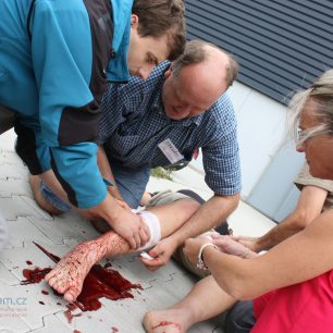 Ošetření krvácení