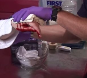 Základní techniky, jak zastavit krvácení by měl každý znát