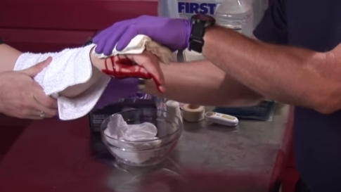 Základní techniky, jak zastavit krvácení by měl každý znát