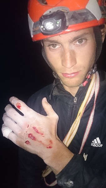 Při prvním slanění přes převis mi to trochu uklouzlo a už byla ruka mezi lanem a skálou 