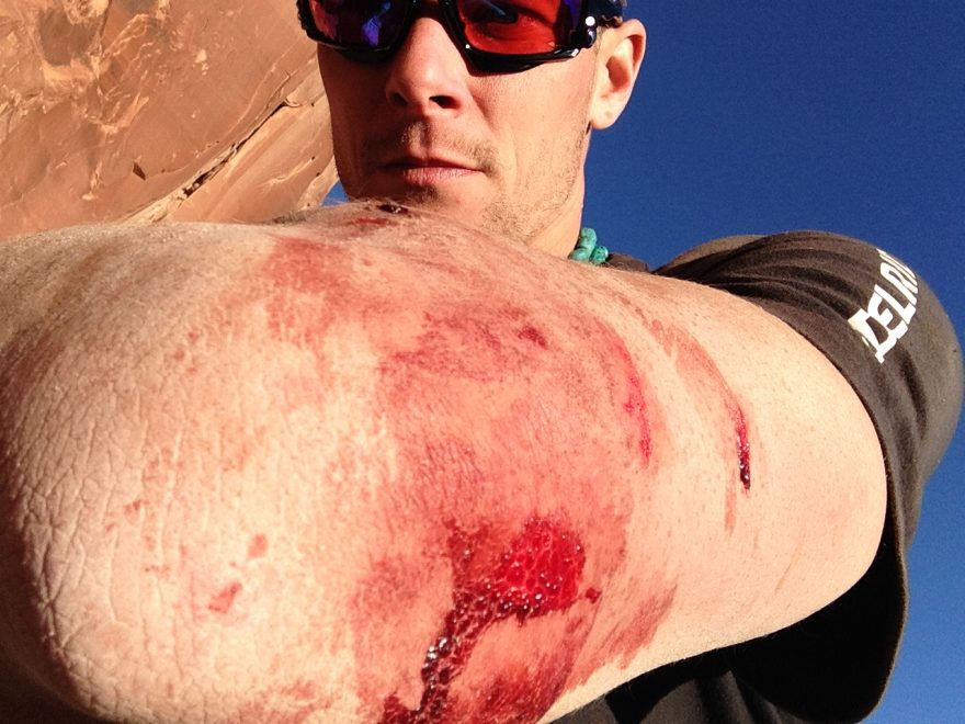 Na povrchová zranění jsou horolezci zvyklí