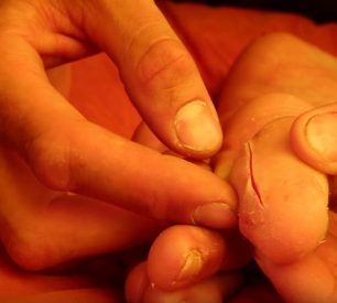 Nepříjemné zranění Jacopo Larchera